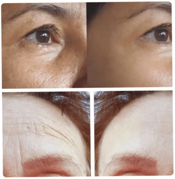 timeless beauty before after results